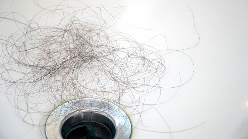 Women Hair Loss More Hair in Toilet